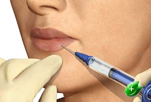 injection mesotherapie